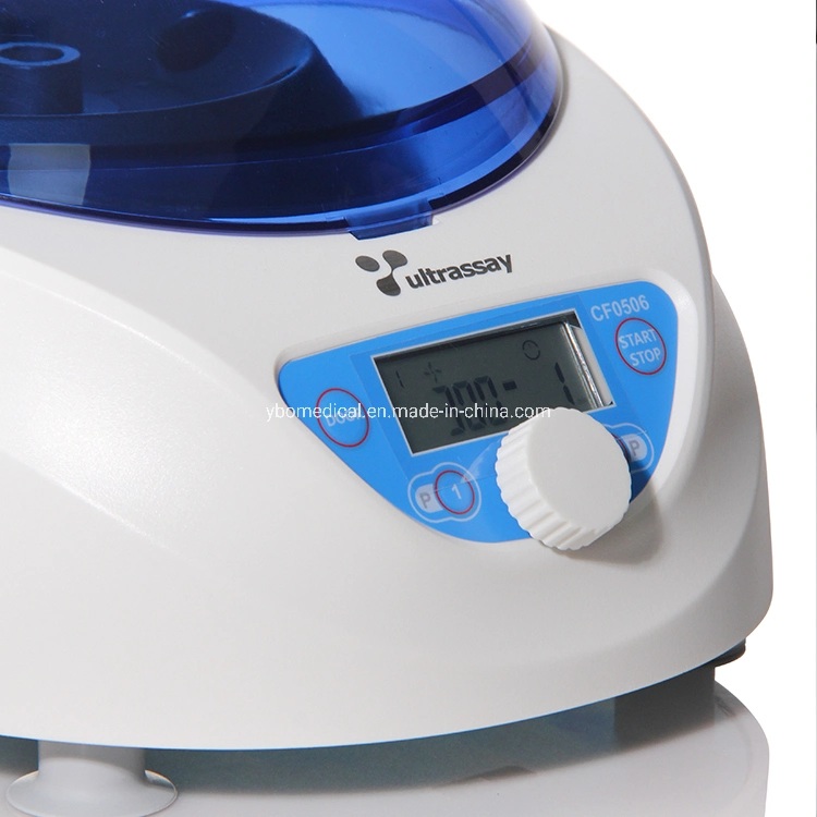 High Quality Prp Centrifuge 300-5000rpm with Rotor Holds up to 15ml/10ml/7ml/5ml X 6 Tubes